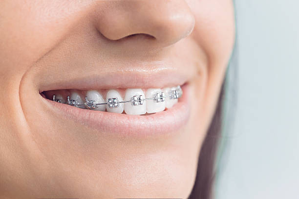 Best Teeth Whitening  in North Utica, IL